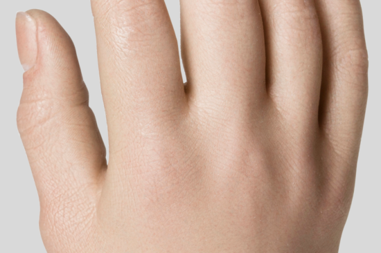 Micro-Coated Surface for Durability